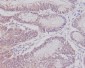 Anti-CD3 epsilon Rabbit Monoclonal Antibody